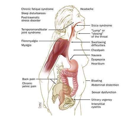 Irritable Bowel Syndrome Buffalo NY